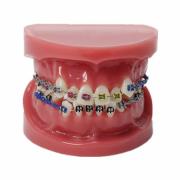 JX®歯科歯列矯正歯模型M3005