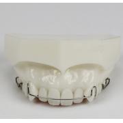 JX®メンテナンス治療・矯正歯模型M3007