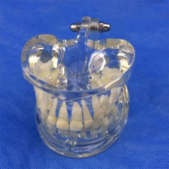 歯列模型 子供 透明乳歯模型 口腔病歯科模型SYM-20