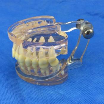 歯列模型 口腔模型 透明歯模型SYM-16
