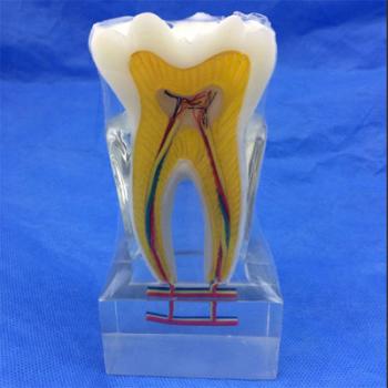  歯模型 口腔模型 歯の解剖模型 6倍大模型SYM-28