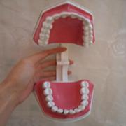 歯列模型 2倍大模型歯 口腔病歯科模型SYM-02
