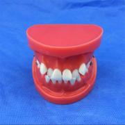 歯列模型 口腔模型 矯正歯模型SYM-26