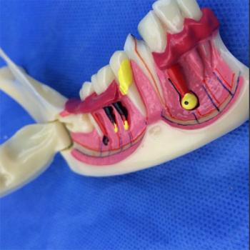 歯模型 口腔模型 下顎解剖模型 SYM-34