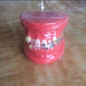  歯列模型 口腔模型 上下歯列矯正模型(セラミックブラケット メタルブラケット) HST-B1－02