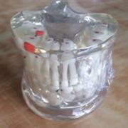 歯列模型 口腔模型 子供 乳歯が永久歯に生え変わる模型C11