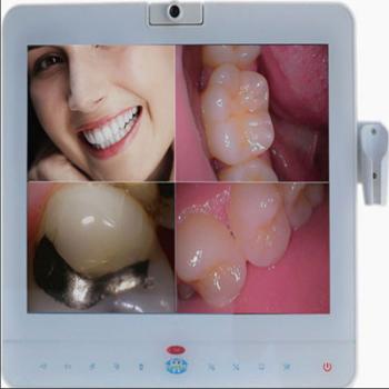 Magenta®歯科用口腔内カメラMD-1500 有線(VGA+VIDEO+USB)