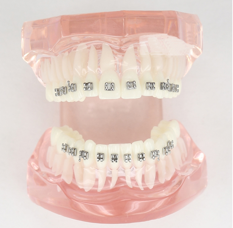 JX®歯科不正咬合歯模型M3001