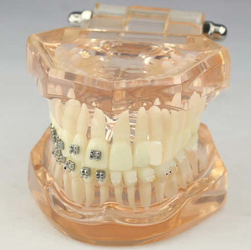 JX®歯科矯正歯模型M3009