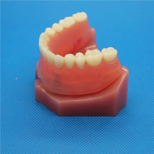 JX®歯科インプラント歯模型M6007